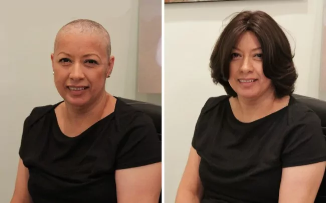 Short Hair Wigs before-after photo