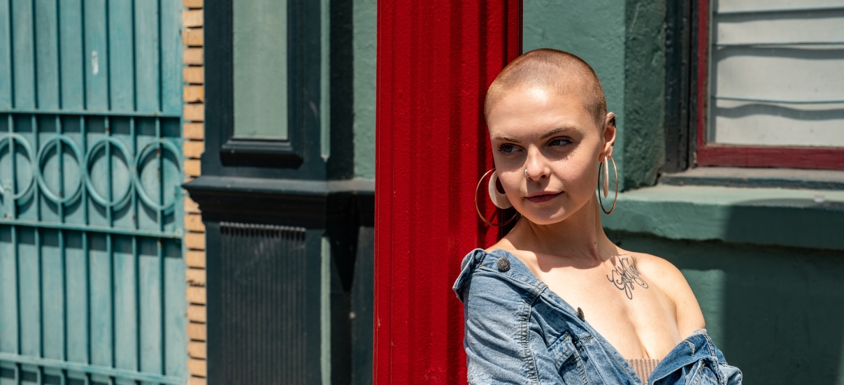 FEMALE PATTERN BALDNESS 