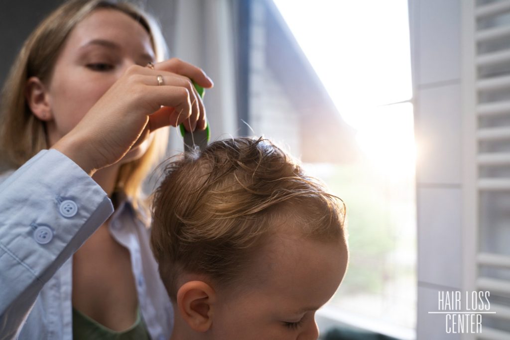 Genetic Hair Loss in Kids