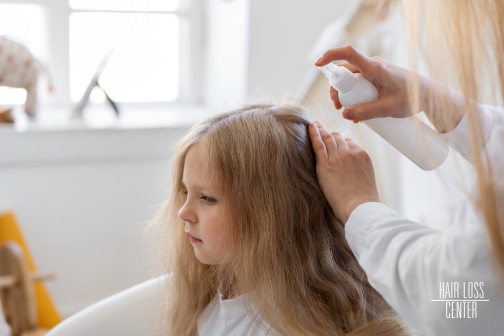 Prevent Hair Loss in Young Children