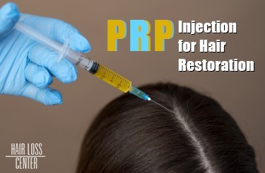 PRP and Hair Loss 