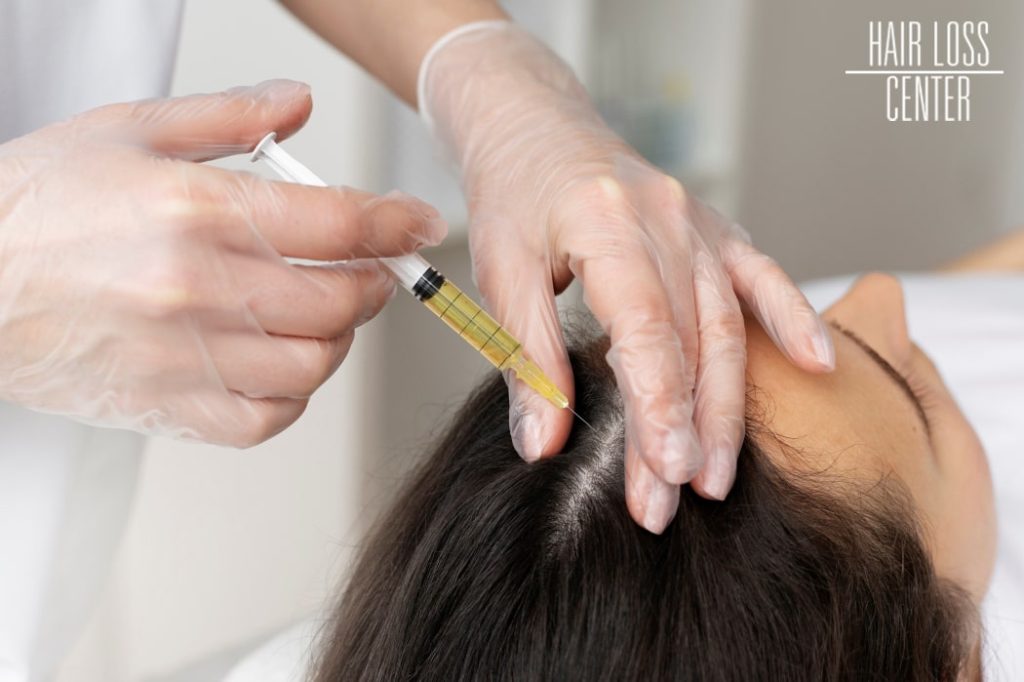 woman-getting-scalp-prp-treatment