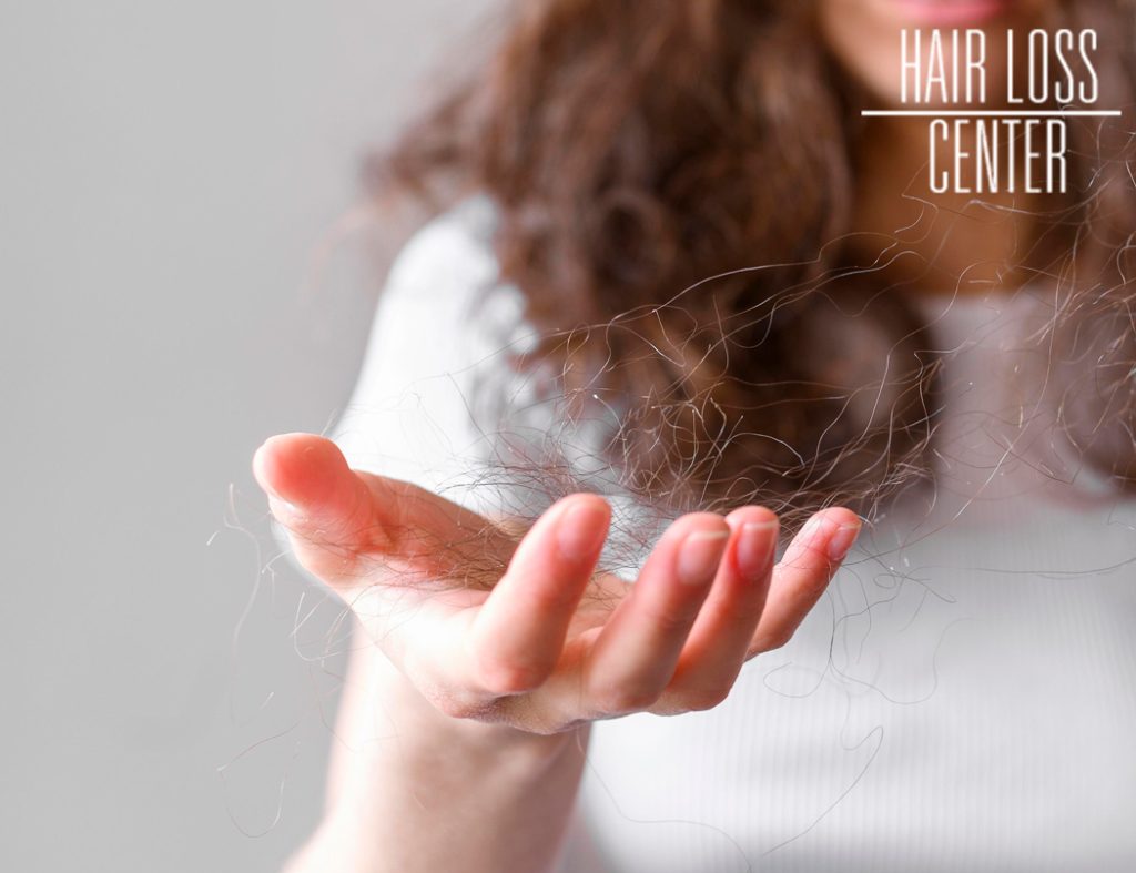 Female with tangled  hair